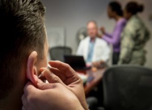 Acupuncture being performed near ear